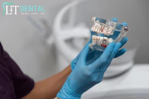 Dental Implants For McKinney Residents