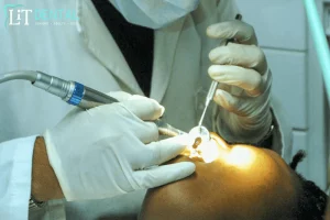 How Long Does Wisdom Teeth Removal Take