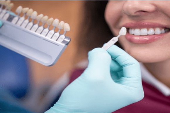 Dental Crown Services in McKinney, TX
