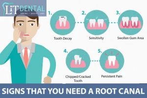igns you need a root canal