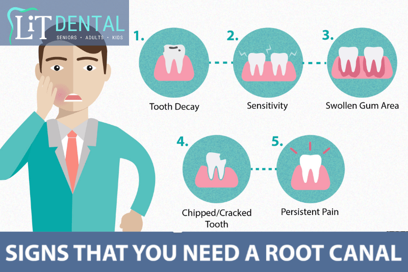 igns you need a root canal