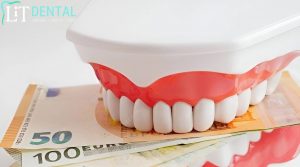 LiT Dental provides affordable teeth whitening options