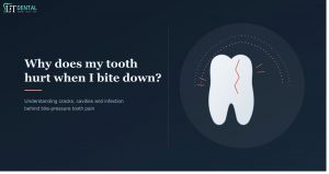 Why Does My Tooth Hurt When I Bite Down