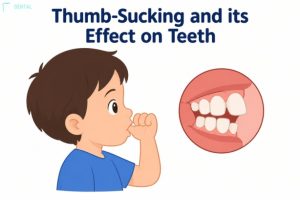Thumb-sucking and its effect on teeth